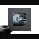 Salt/Kryophobia - Röntgen (lim. 7 EP)